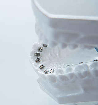 吉祥寺駅 北口・吉祥寺エル矯正歯科・なぜ、舌側矯正にこだわるのか