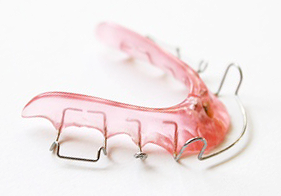 吉祥寺駅 北口・吉祥寺エル矯正歯科・Ⅰ期矯正治療