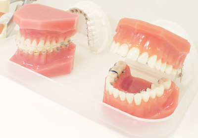 吉祥寺駅 北口・吉祥寺エル矯正歯科・Ⅱ期矯正治療