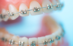 吉祥寺駅 北口・吉祥寺エル矯正歯科・表側