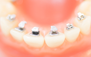 吉祥寺駅 北口・吉祥寺エル矯正歯科・裏側