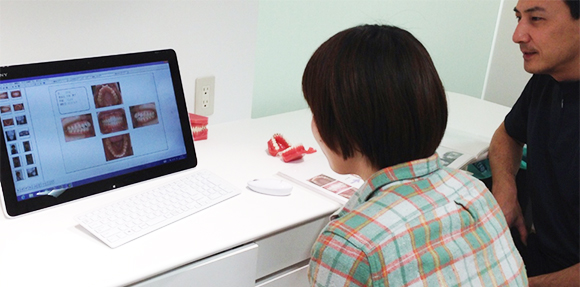 わっ、この方向からの自分の歯並び初めて見た